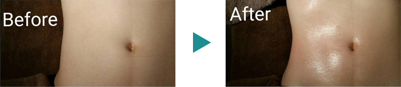 Before After