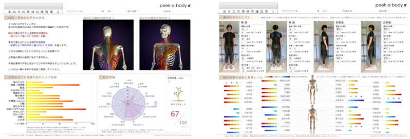 最新型の3D姿勢歪み分析システム